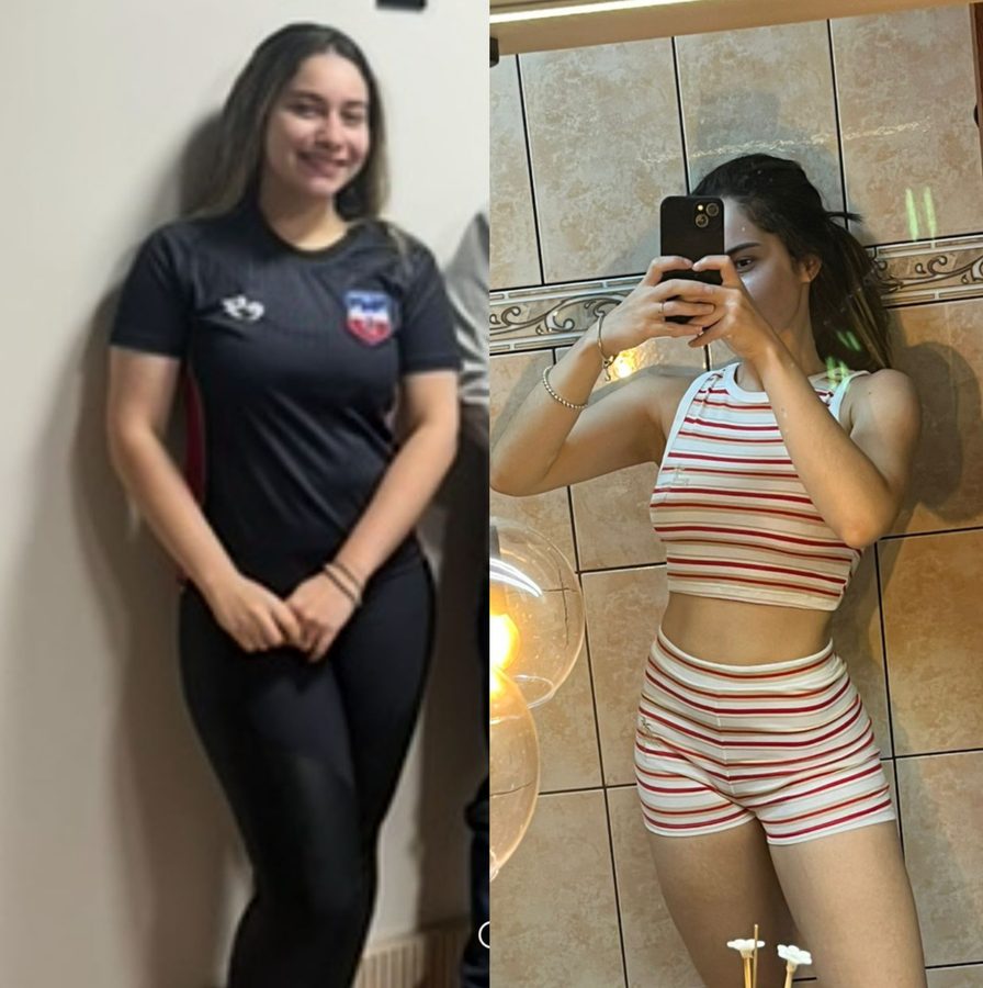 Ana Valentim antes e depois
