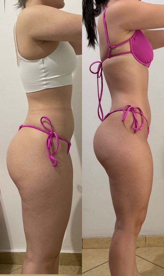 Raphaella de perfil, antes e depois